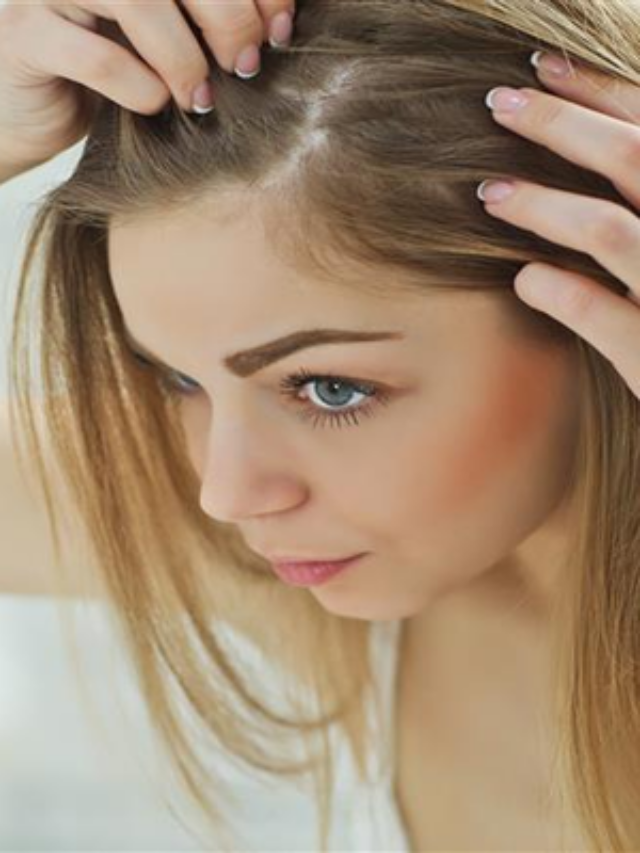 5 alimentos que ajudam a combater a queda de cabelos